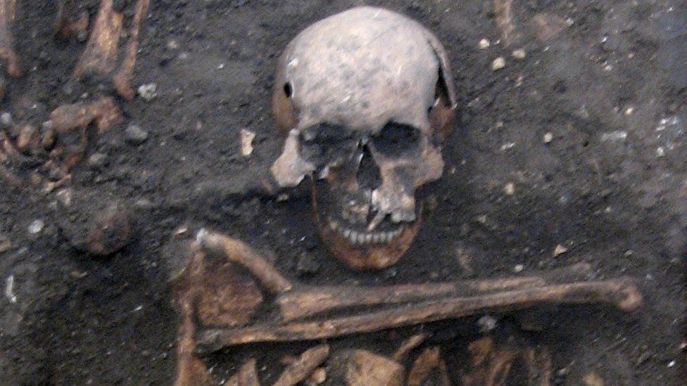 Young adult male skeleton from the late 14th century, buried in the grounds of medieval Cambridge’s charitable hospital